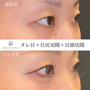LOUIS CLINIC 二子玉川院【ルイクリニック】 小松 塁医師の症例