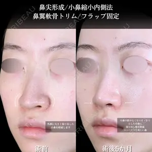 症例