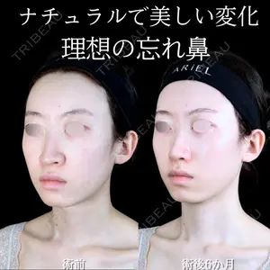 症例