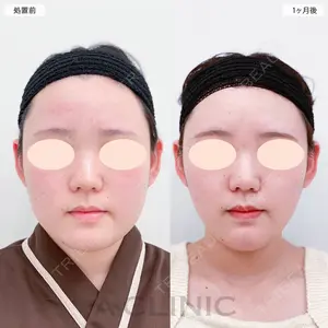 A CLINIC（エークリニック） 大阪院 田窪 賢志郎医師の症例