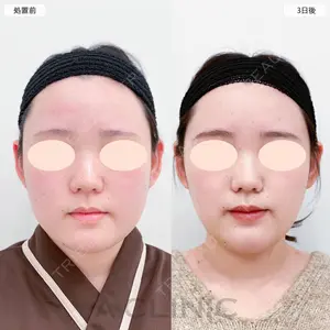 A CLINIC（エークリニック） 大阪院 田窪 賢志郎医師の症例