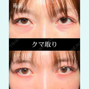 症例