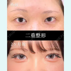 症例