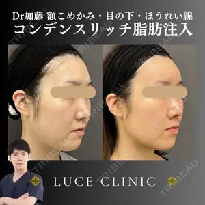 ルーチェクリニック 銀座院 加藤晴之輔医師の症例