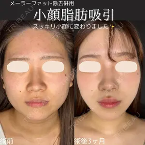 ルラ美容クリニック 仙台院 橋本 英樹医師の症例