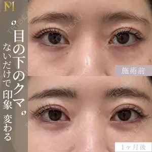 症例