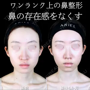 症例