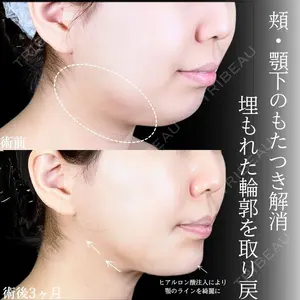 アリエル美容クリニック 大宮院 鈴木　桂介医師の症例