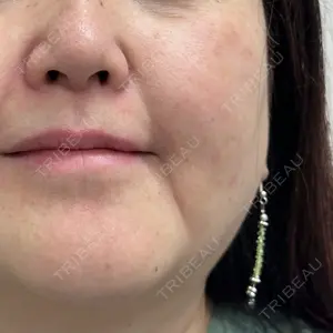 GRACY TOKYO CLINIC【グレイシートウキョウクリニック】 大西 真代医師の症例