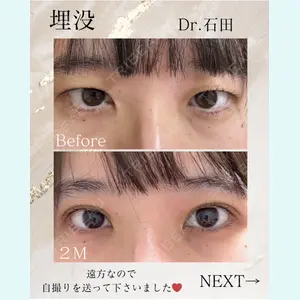東京美容クリニック 表参道本院 石田 麻佐絵医師の症例