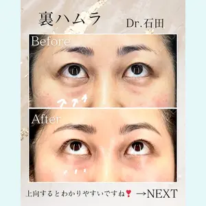 東京美容クリニック 表参道本院 石田 麻佐絵医師の症例