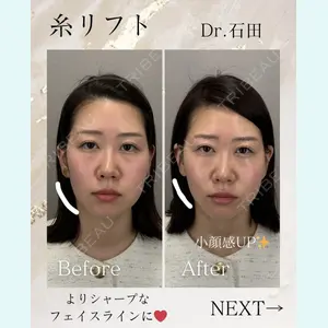 東京美容クリニック 表参道本院 石田 麻佐絵医師の症例