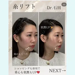 東京美容クリニック 表参道本院 石田 麻佐絵医師の症例