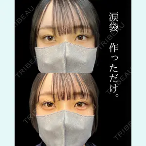 症例