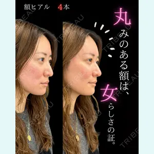 症例