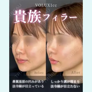 症例
