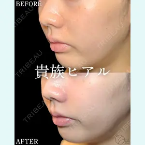 Code Beauty Clinic 名古屋院 橋本 祥平医師の症例