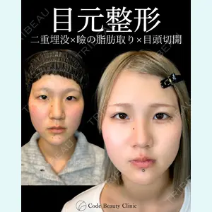 Code Beauty Clinic 名古屋院 橋本 祥平医師の症例