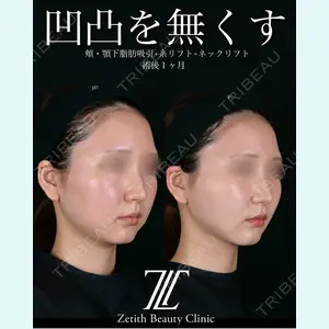 Zetith Beauty Clinic 池袋院 北村 翔医師の症例