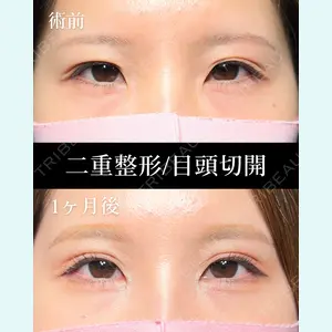 症例