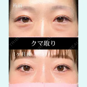 症例