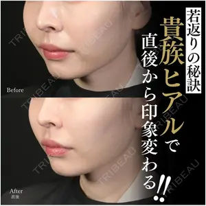 Zetith Beauty Clinic 池袋院 北村 翔医師の症例