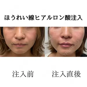 おおたかの森ビューティークリニックの症例