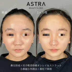 症例