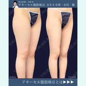 東京シンデレラ美容外科 新宿院 吉原 伯医師の症例