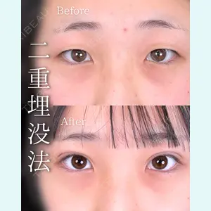 症例