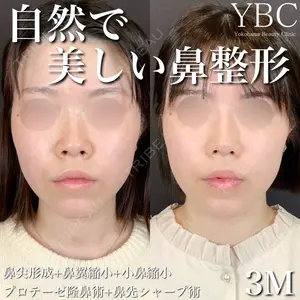 YBC横浜美容外科 大宮院 磯村 亮輔医師の症例