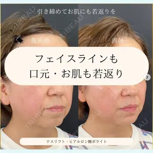 自由が丘ウェルエイジングビューティークリニックの症例