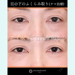 症例