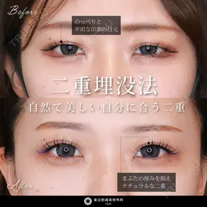 東京形成美容外科 船橋院 弓削田　浩主医師の症例