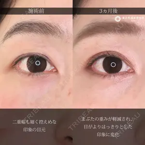 東京形成美容外科 船橋院の症例