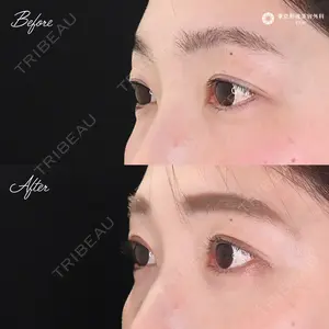 東京形成美容外科 船橋院の症例