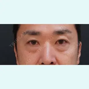 症例