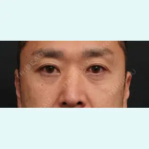 症例