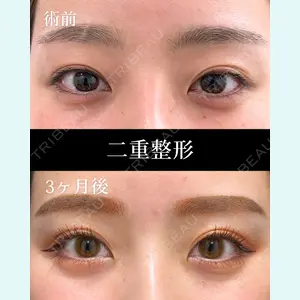 症例