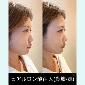 HAAB×DREAM BEAUTY CLINIC 東京本院 佐野 圭医師の症例