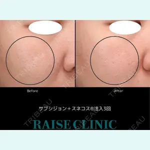 RAISE CLINIC 【レイズクリニック】の症例