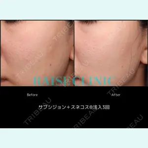 RAISE CLINIC 【レイズクリニック】の症例