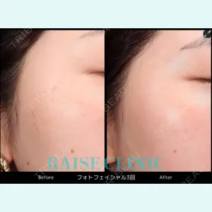 RAISE CLINIC 【レイズクリニック】の症例