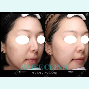 RAISE CLINIC 【レイズクリニック】の症例