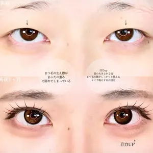 アリエル美容クリニック 大宮院 鈴木　桂介医師の症例