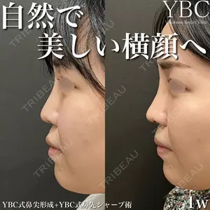 YBC横浜美容外科 大宮院 磯村 亮輔医師の症例