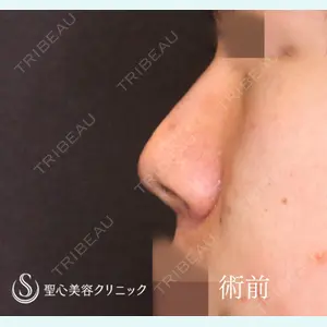 聖心美容クリニック 六本木院 川端 優也医師の症例