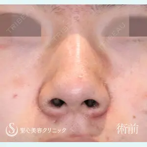 聖心美容クリニック 六本木院 川端 優也医師の症例
