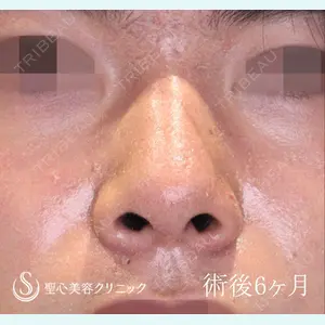 聖心美容クリニック 六本木院 川端 優也医師の症例