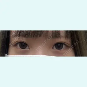 おおたかの森ビューティークリニックの症例